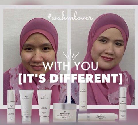 Testimoni Nutriwhite