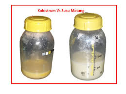Kolostrum terbaik untuk antibodi bayi