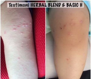 testimoni herbal blend