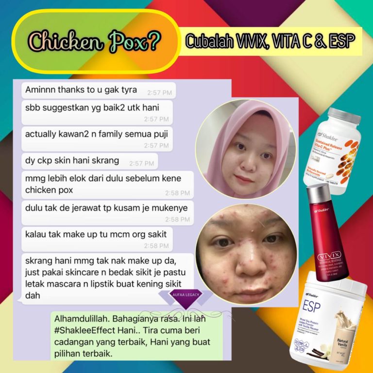 testimoni hilang parut chicken pox di wajah