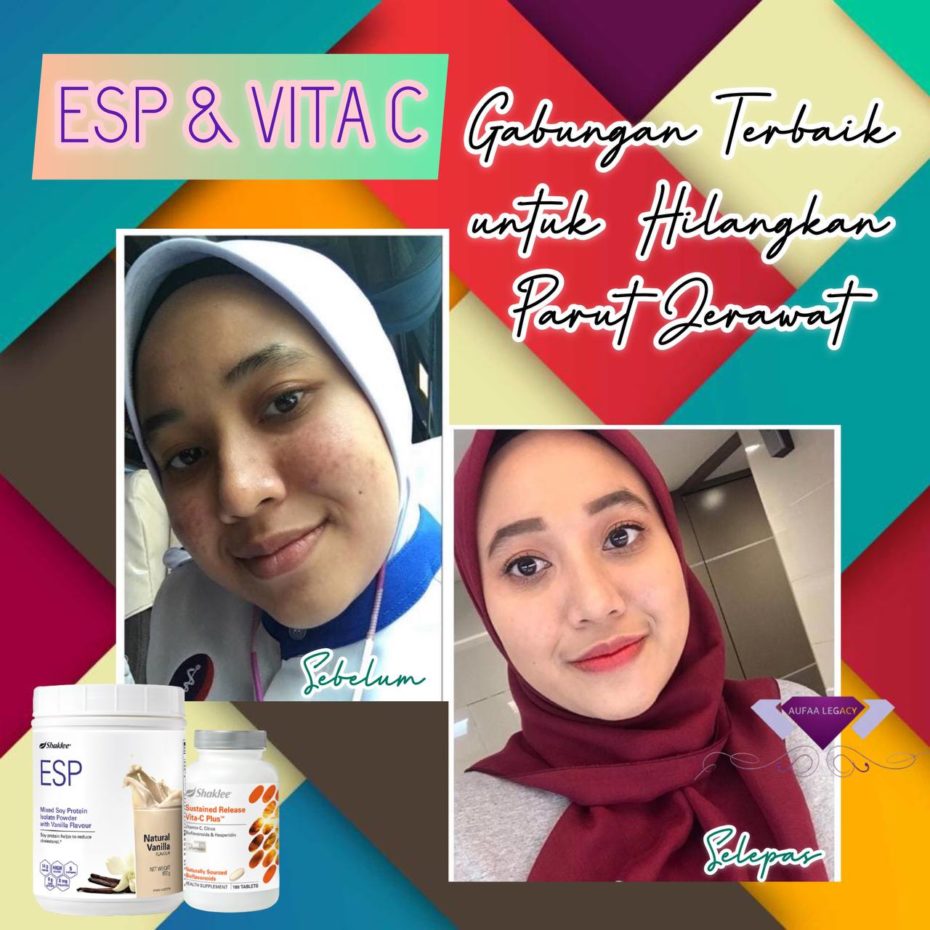 testimoni hilang parut jerawat