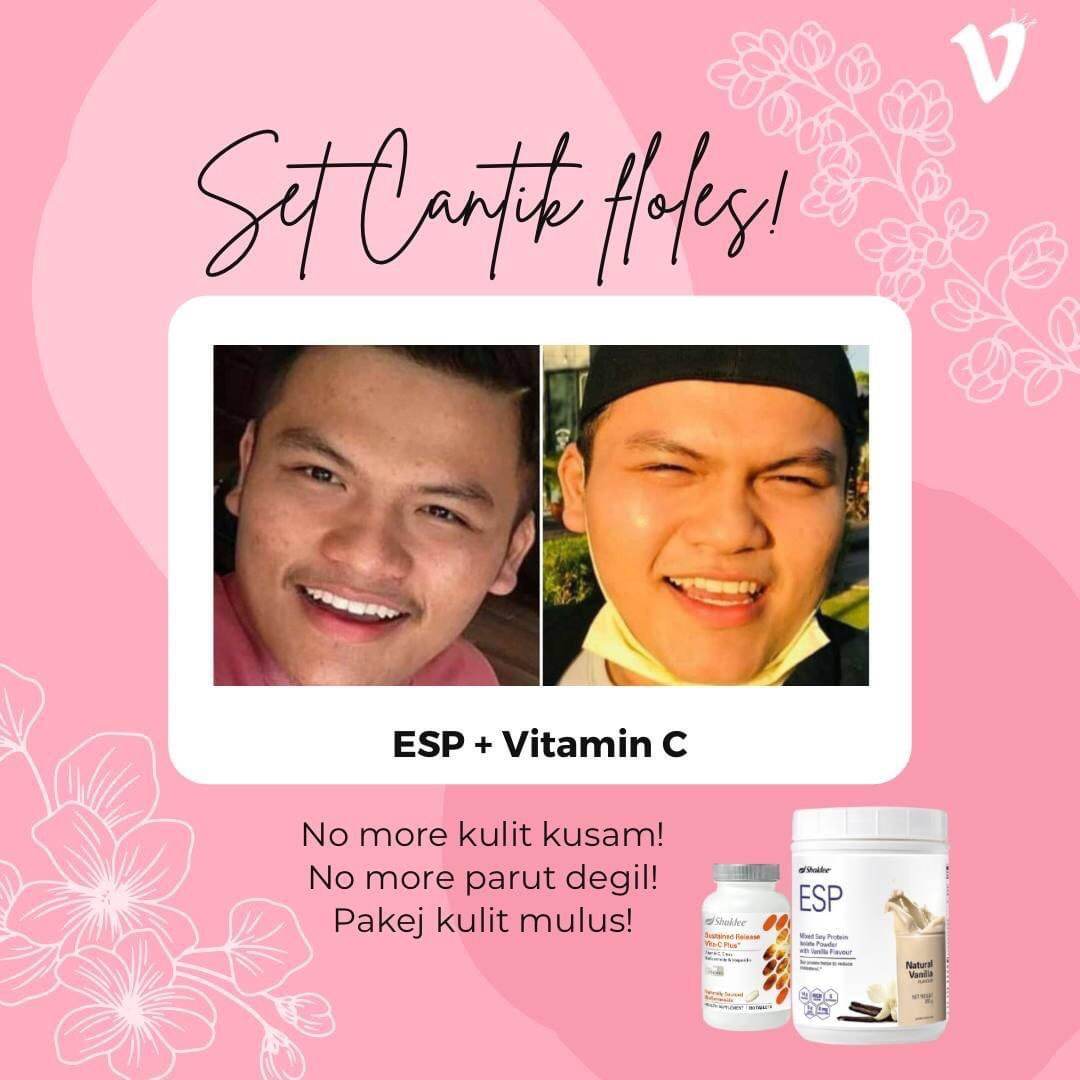 Vitamin Kulit Cantik